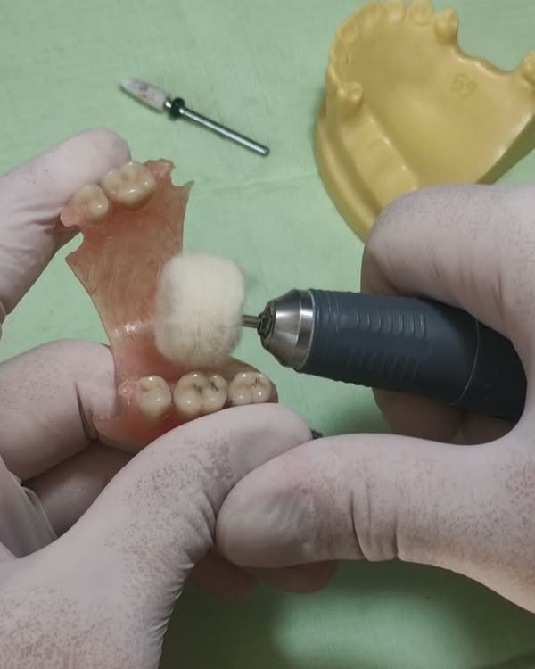 Dario puliendo una prótesis en el laboratorio del consultorio